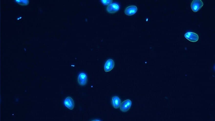 Giardia duodenalis cyster farget med FITC og DAPI.