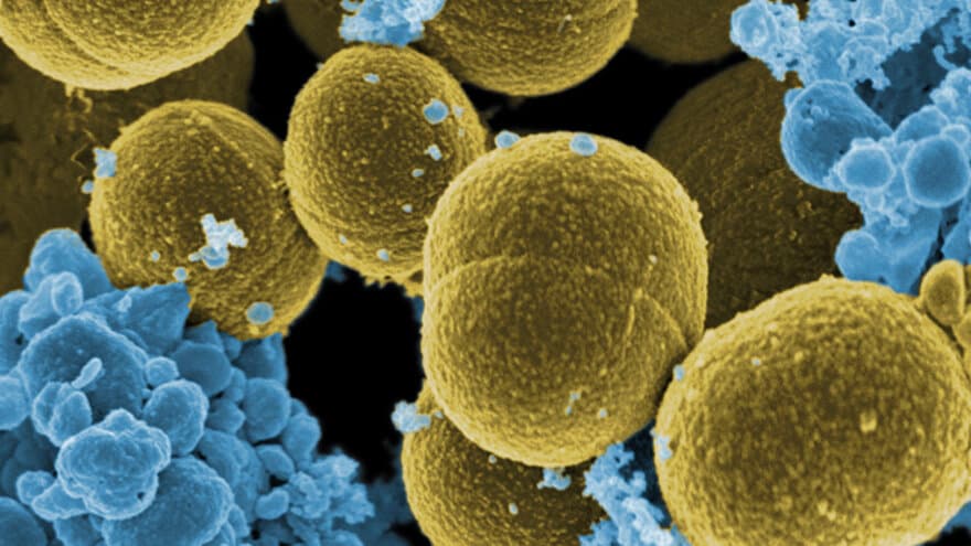  Staphylococcus aureus - National Institutes of Health, USA